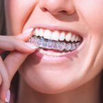 Achieving a Perfect Smile with Invisalign: Insights from Sydney's Top Clinics