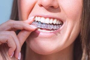 Achieving a Perfect Smile with Invisalign: Insights from Sydney's Top Clinics