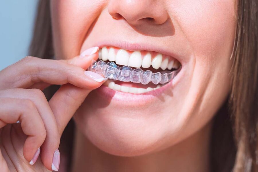 Achieving a Perfect Smile with Invisalign: Insights from Sydney’s Top Clinics